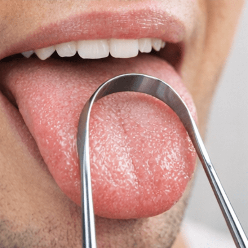Stainless Steel Tongue Scraper